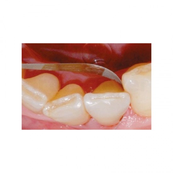 Ortho-Strips-Tiras-Manuales-Grano-Fino-2