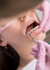 ¿Qué son los muelles de ortodoncia?